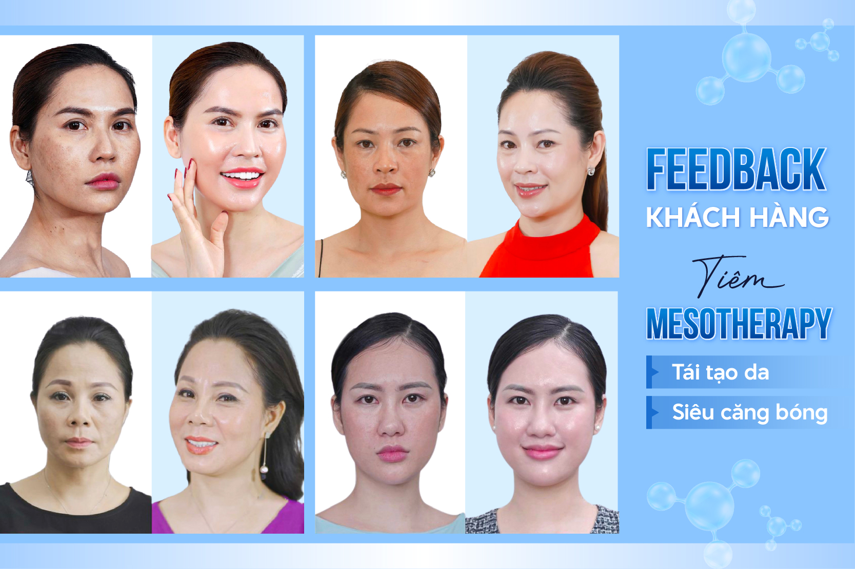 Mesotherapy Căng Bóng Trắng Sáng là phương pháp Trẻ hóa da nổi bật tại Anh Khuê Beauty Clinic được nhiều chị em yêu thích