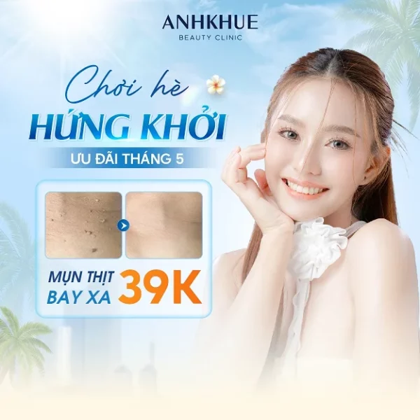 mụn thịt anh khuê beauty clinic