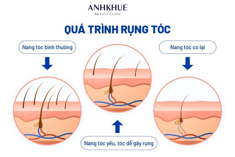 Mùa rụng tóc có thể sẽ khác nhau qua từng người do ảnh hưởng bởi yếu tố cá nhân, môi trường và điều kiện sống