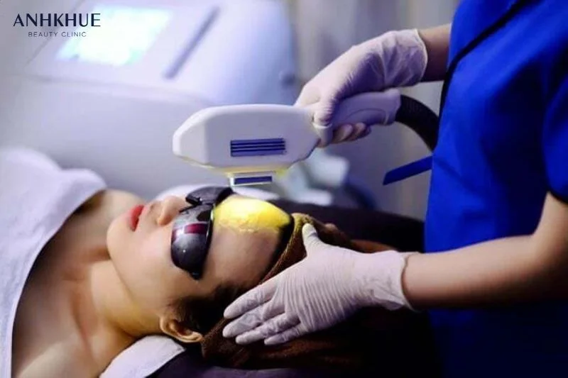 Công nghệ xóa nốt ruồi Laser Fractional CO2 không để lại sẹo