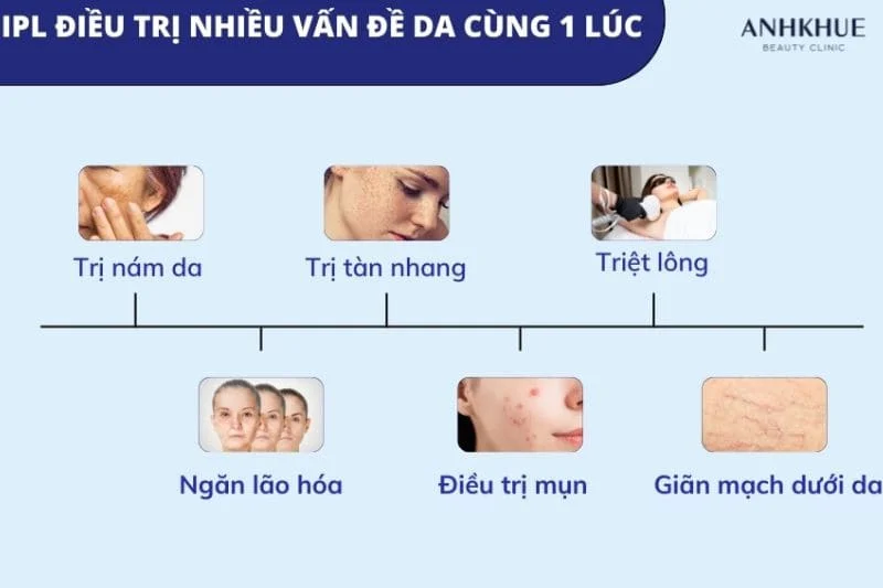 IPL là công nghệ tiên tiến của ngành thẩm mỹ điều trị da hiện nay