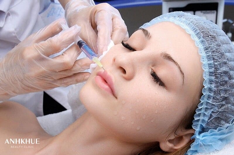 Tiêm Filler giúp xóa nếp nhăn, giảm các dấu hiệu lão hóa, cải thiện khuyết điểm trên khuôn mặt và mang lại vẻ ngoài trẻ trung, tươi tắn