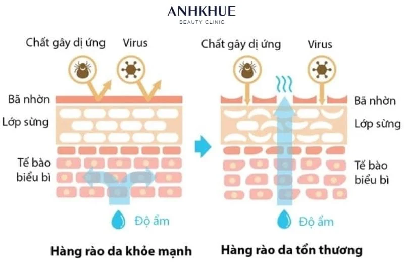 Có nhiều yếu tố làm suy yếu hàng rào bảo vệ da, làm da dễ bị khô và nhạy cảm hơn