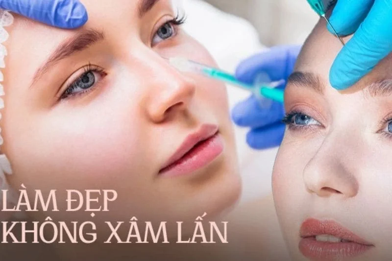 Tiêm Filler giúp che lấp các nếp nhăn, phục hồi nhan sắc khuôn, cải thiện các khuyết điểm trên khuôn mặt, khắc phục các dấu hiệu lão hóa