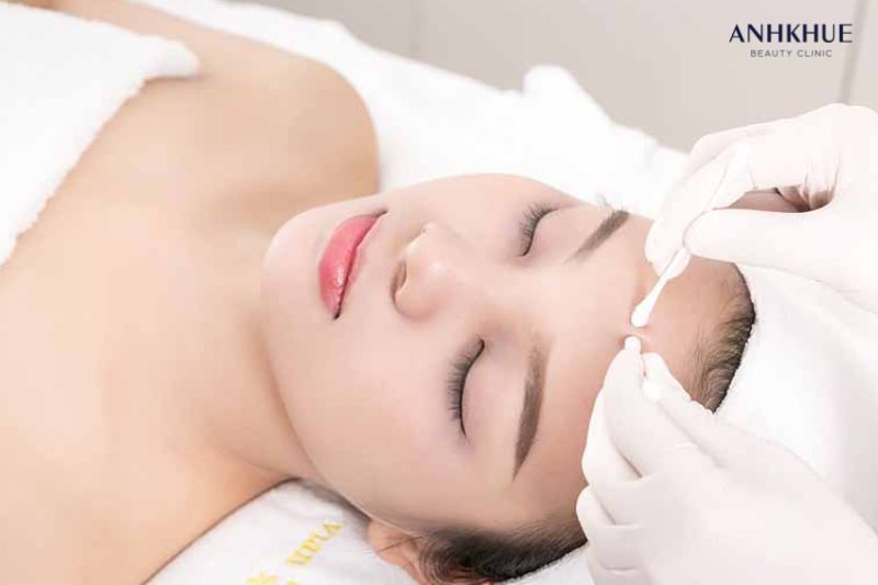 Acneskin lấy nhân mụn bằng tăm bông với quy trình chuẩn y khoa