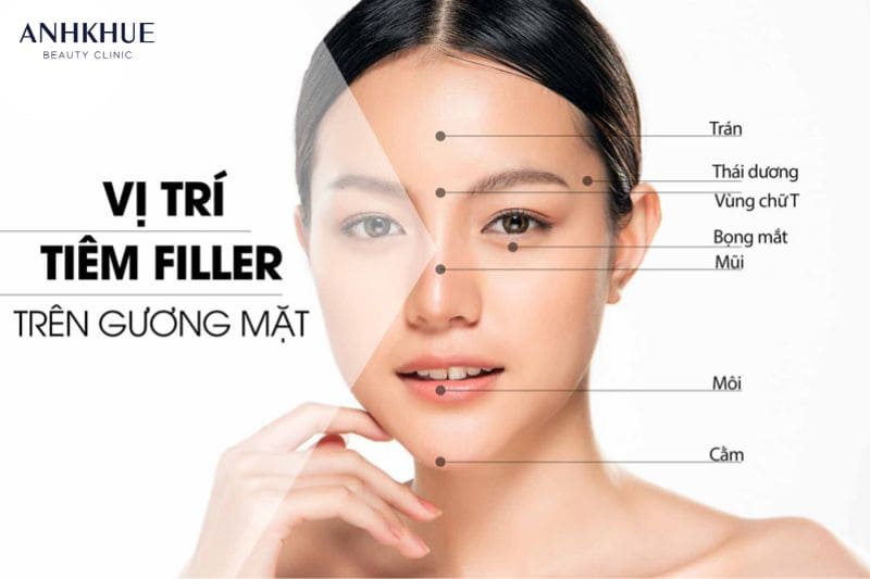 Tiêm filler có thể áp dụng cho nhiều vị trí khác nhau