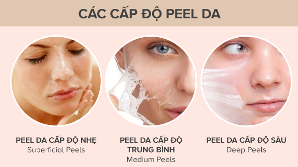 Peel làm trắng da có các bước nông, trung bình và sâu