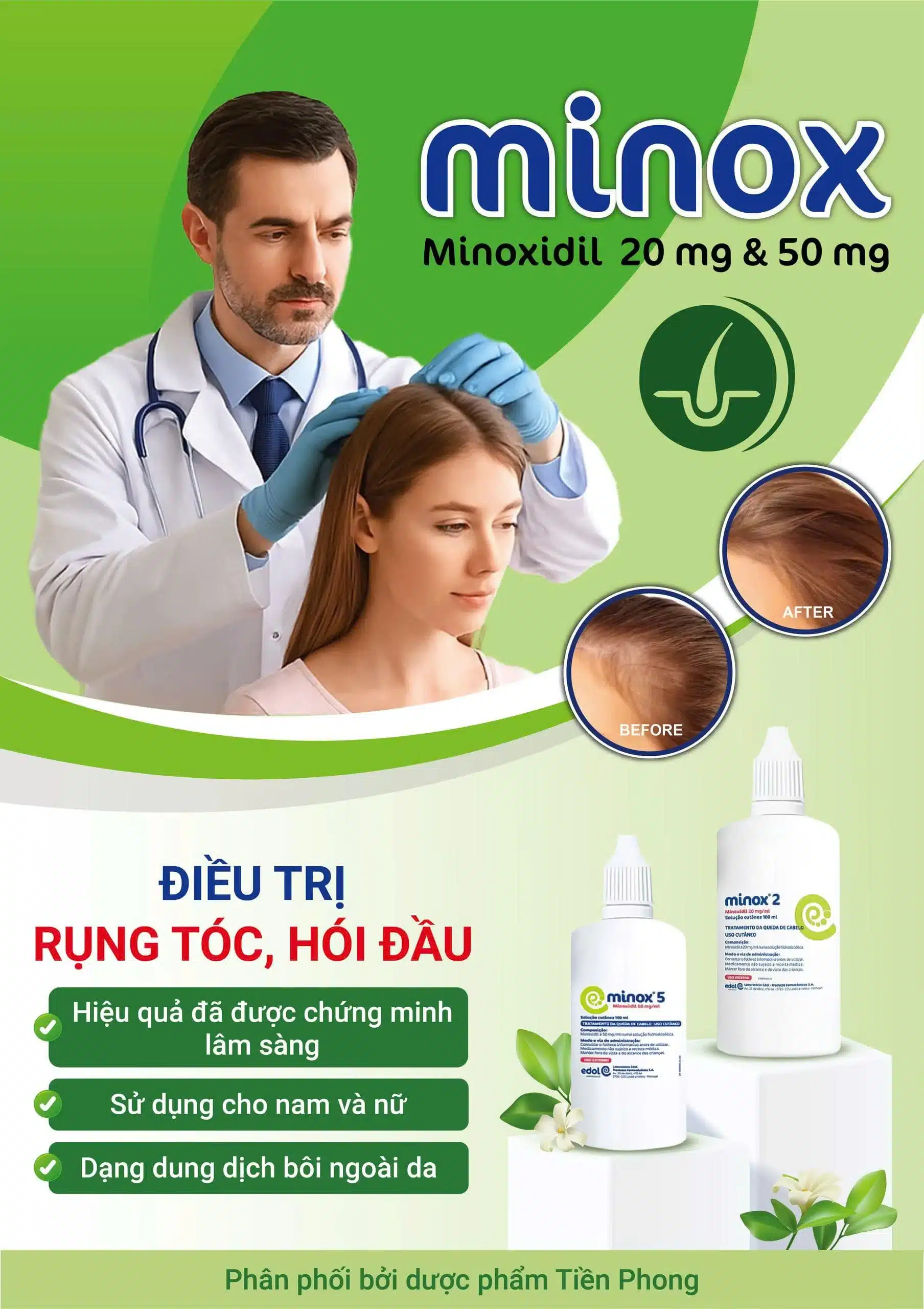 minox-tri-rung-toc (3)