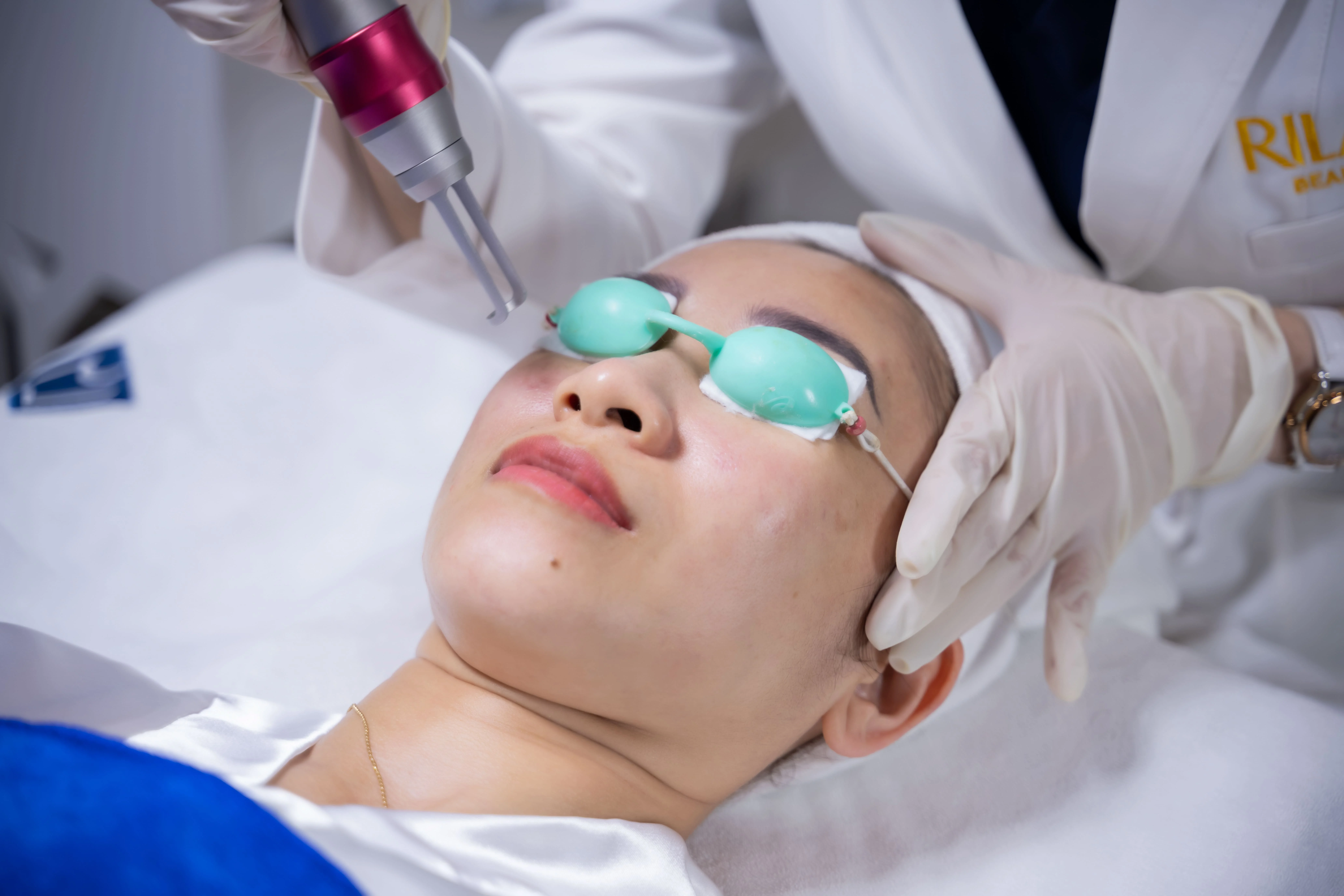 Laser White Pro loại bỏ các sắc tố không mong muốn, xử lý nám sạm, tàn nhang, đốm nâu… một cách an toàn và hiệu quả trên mọi loại da