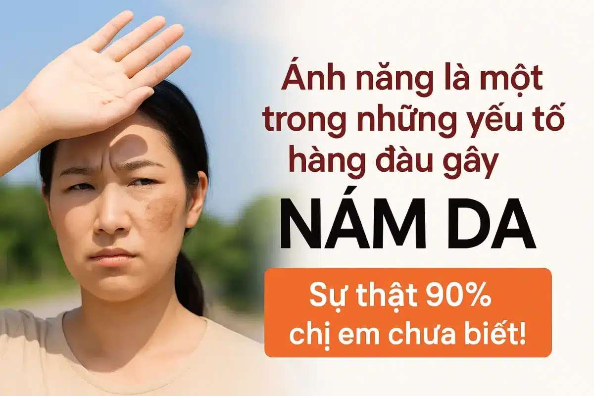 Ánh nắng mặt trời chính là “thủ phạm giấu mặt” khiến tình trạng nám trở nên dai dẳng và khó điều trị hơn