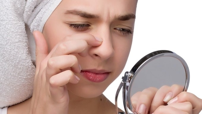 Mũi là khu vực có nhiều lỗ chân lông và tuyến bã nhờn nên rất dễ nổi mụn