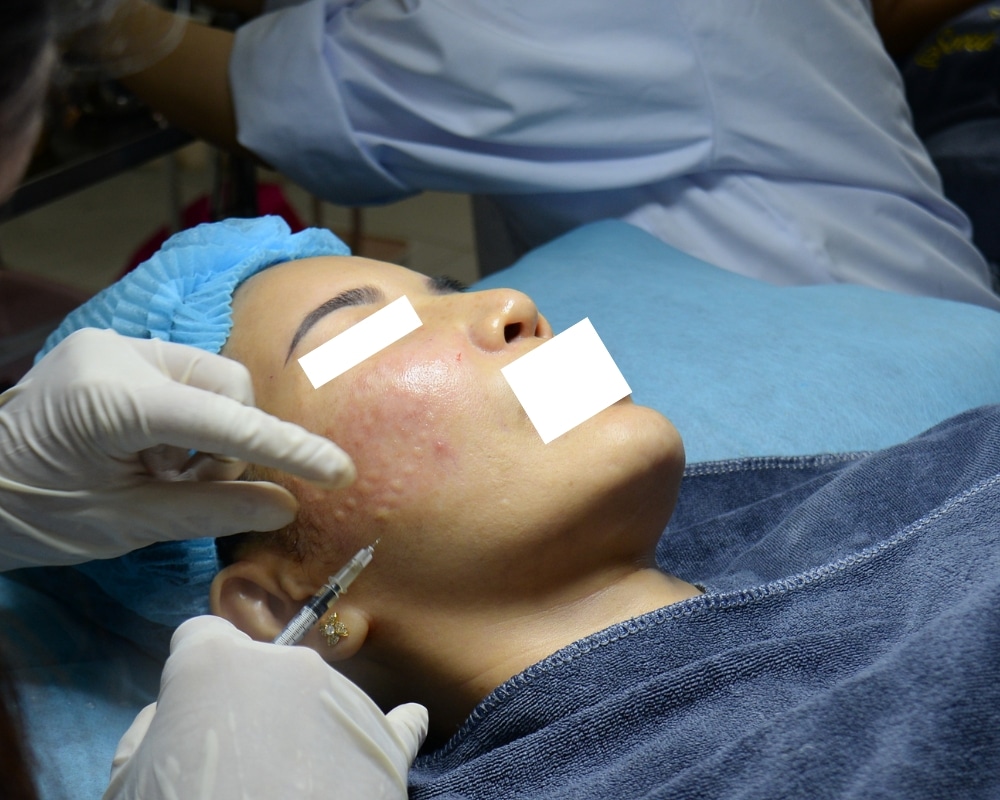 Liệu pháp trẻ hóa da PRP và Peel da phù hợp với cả nam và nữ, đặc biệt là những người có các vấn đề về da hoặc mong muốn cải thiện, duy trì làn da khỏe đẹp