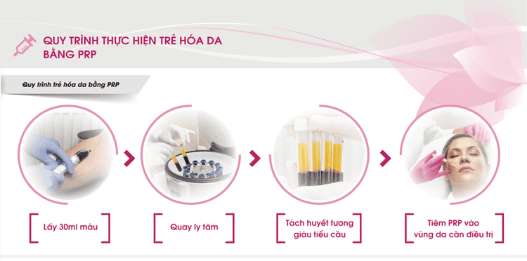 Quy trình thực hiện trẻ hóa da bằng phương pháp PRP