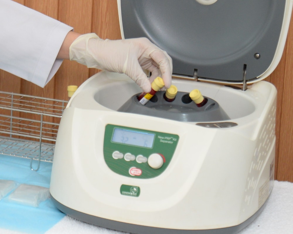 PRP cung cấp các dưỡng chất giúp nuôi dưỡng da hiệu quả và tăng độ đàn hồi cho da