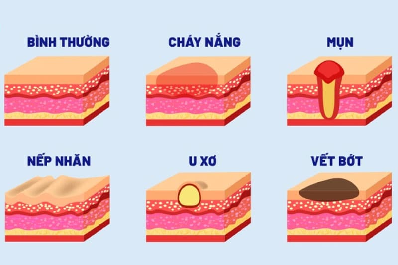 Da tổn thương có thể là kết quả của chấn thương, cháy nắng, viêm da tiếp xúc hoặc nhiễm trùng, bệnh tự miễn, di truyền