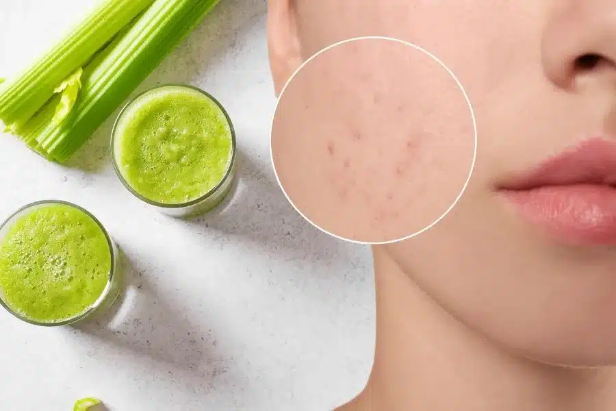 Nước ép cần tây có tác dụng đẩy lùi lão hóa, phục hồi da hư tổn, trắng sáng và đều màu da