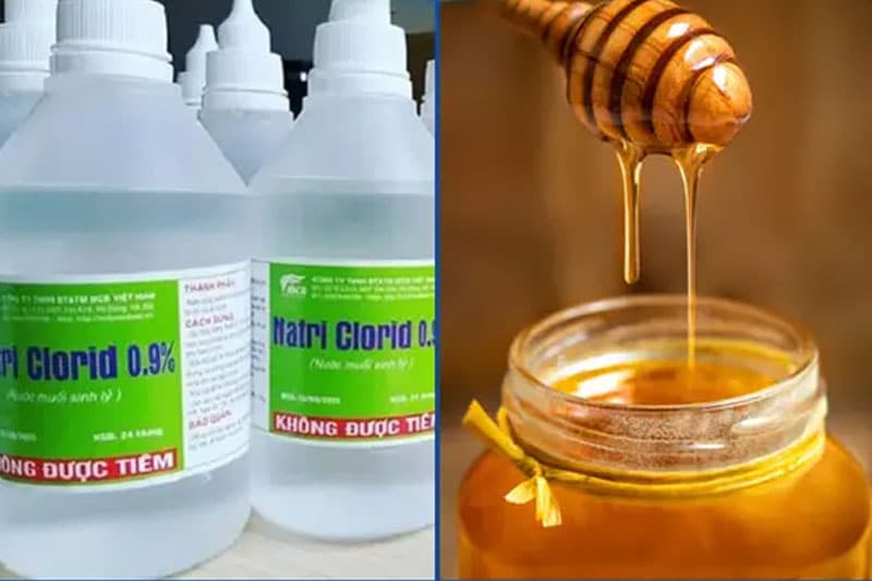 Kết hợp nước muối sinh lý với mật ong có công dụng làm dịu mẩn đỏ, mờ thâm mụn