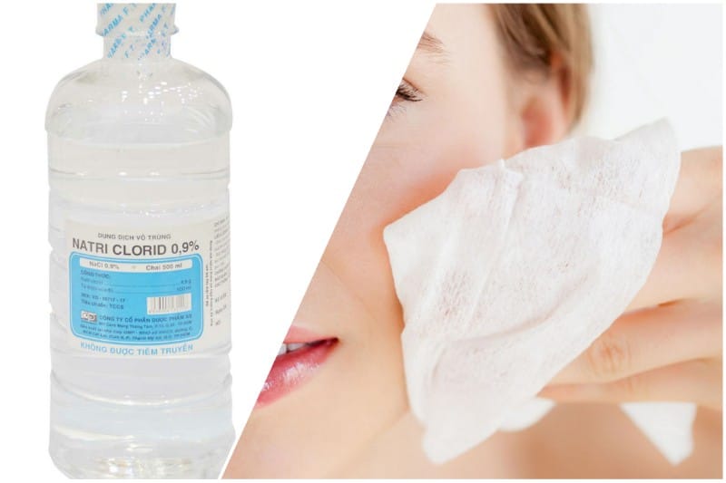 Nước muối sinh lý không phải là thuốc đặc trị mụn, nhưng có thể hỗ trợ làm sạch da và cải thiện mụn mức độ nhẹ