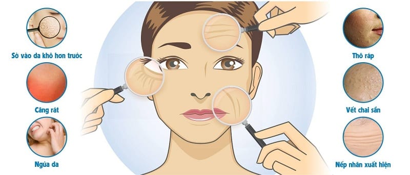 Với da khô, nỗi ám lớn nhất chính là làn da luôn bong tróc, nứt nẻ và khô căng, nhất là vào mùa đông