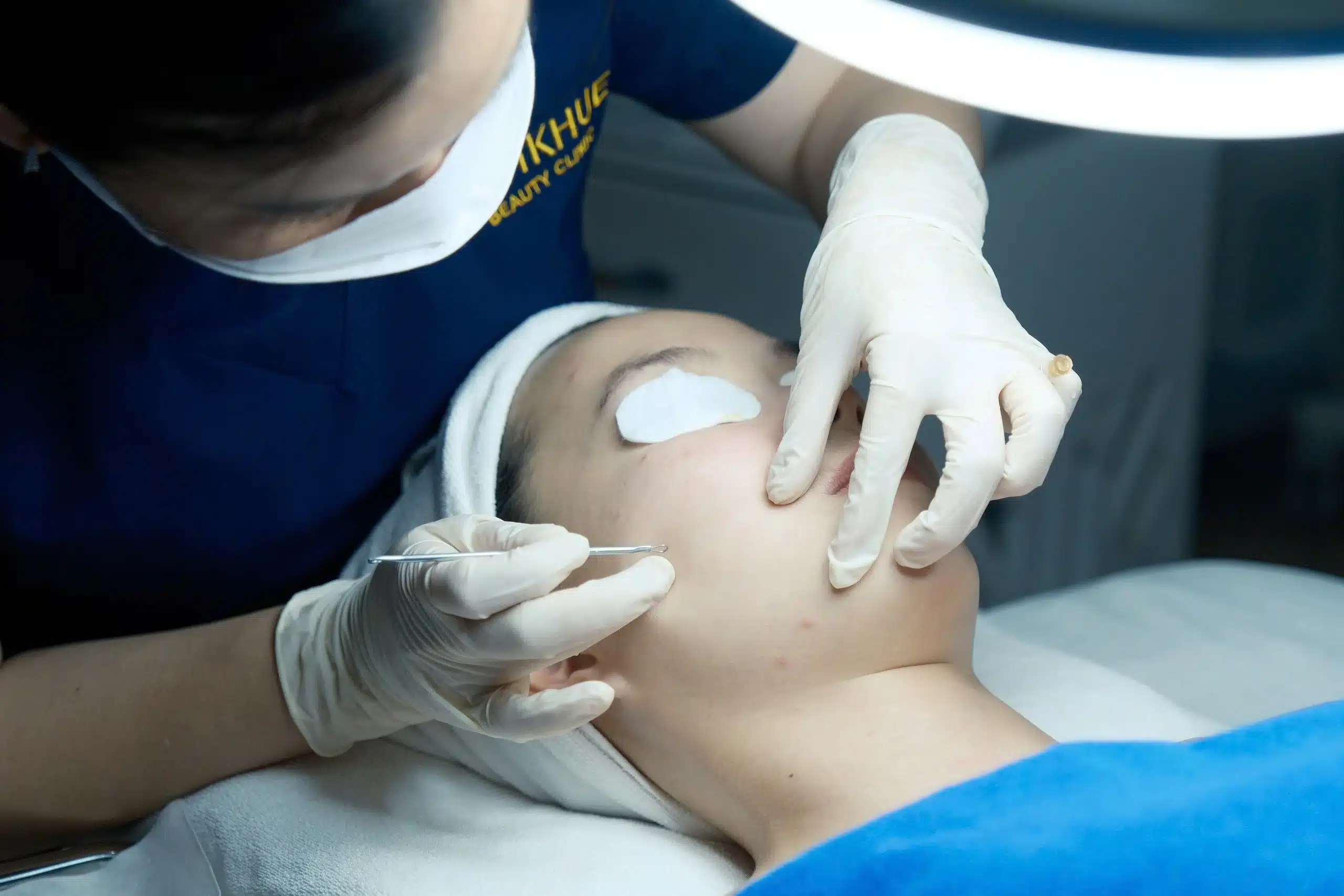 Liệu trình Acneskin “12 bước“ mang lại hiệu quả vượt trội làm sạch sâu, lấy nhân mụn chuẩn vô khuẩn