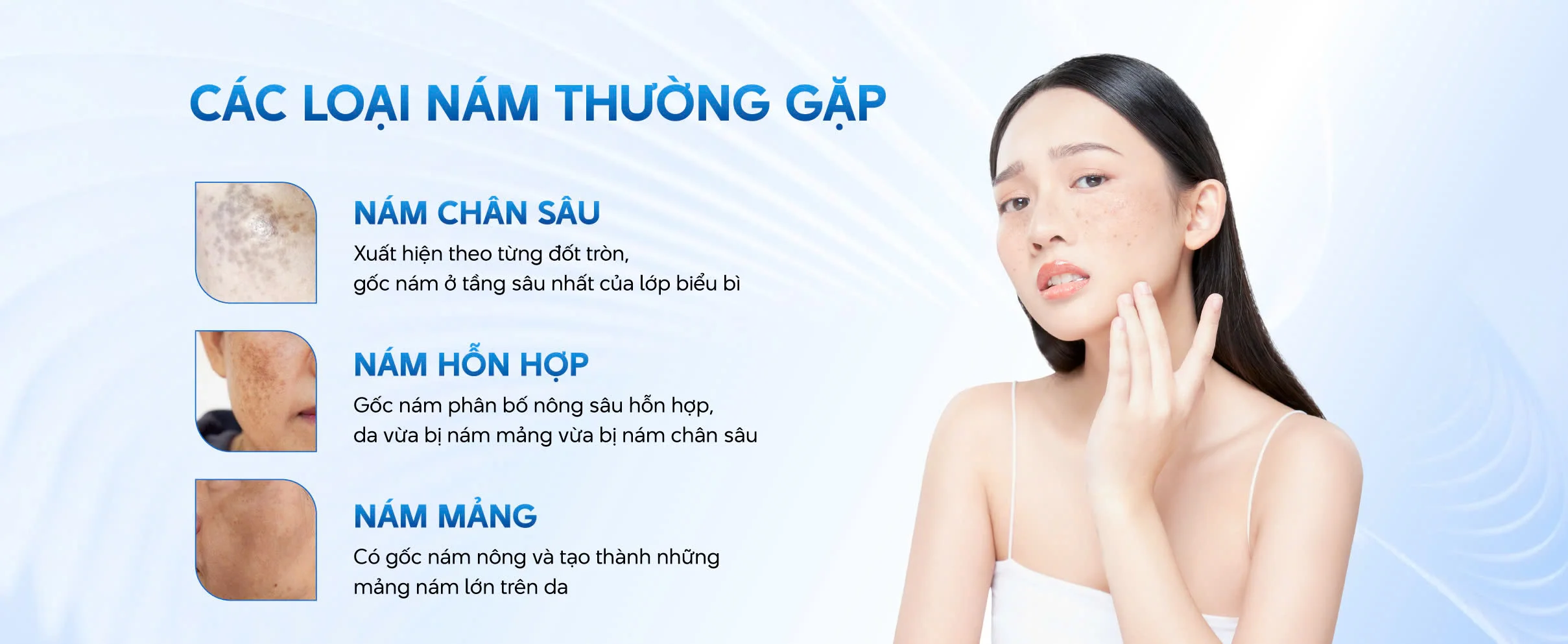 Nám da làm mất thẩm mỹ, ảnh hưởng đến tâm lý và sự tự tin của nhiều người