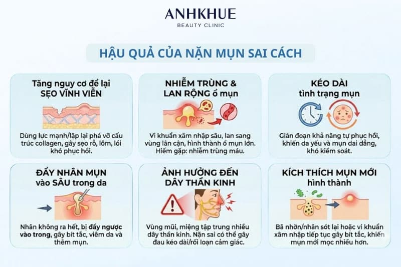 Tự nặn mụn gây ra nhiều tổn thương cho da, thậm chí có thể để lại sẹo rỗ, sẹo thâm trên da mặt