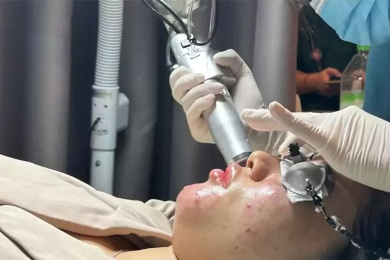 Laser ND:YAG có hiệu quả điều trị sắc tố nên sẽ xử lý được thâm đen, thâm đỏ