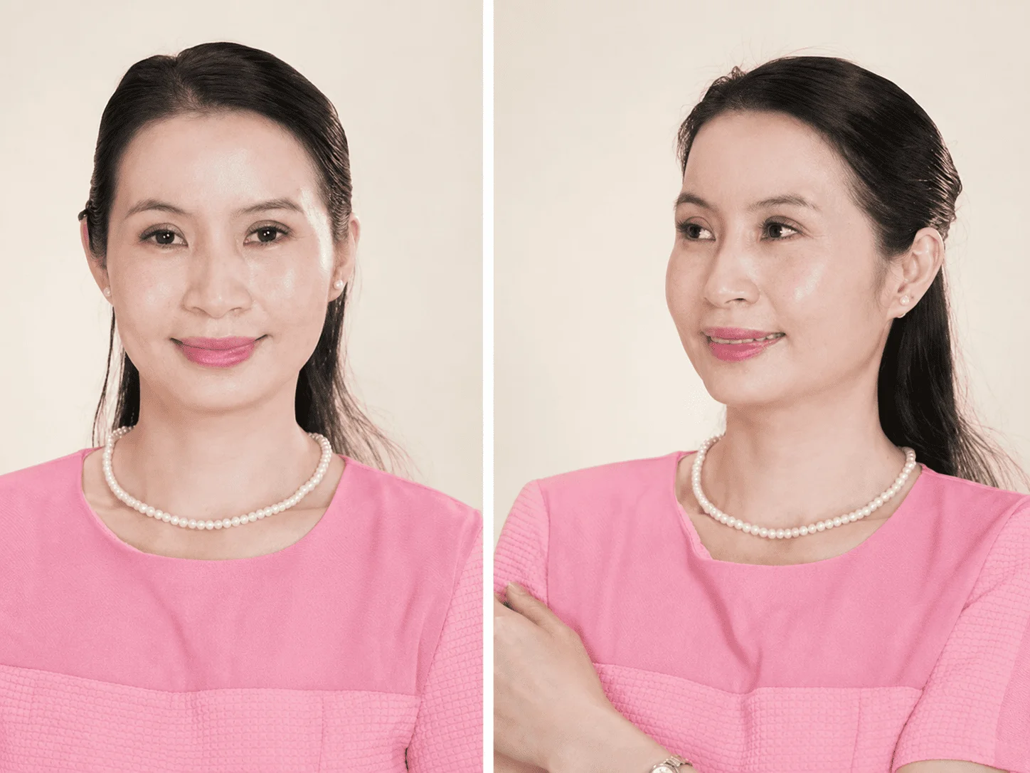 Sau khi tin tưởng điều trị nám tại Anh Khuê Beauty Clinic, da đủ ẩm hơn, nếp nhăn giảm và đốm nâu mờ dần