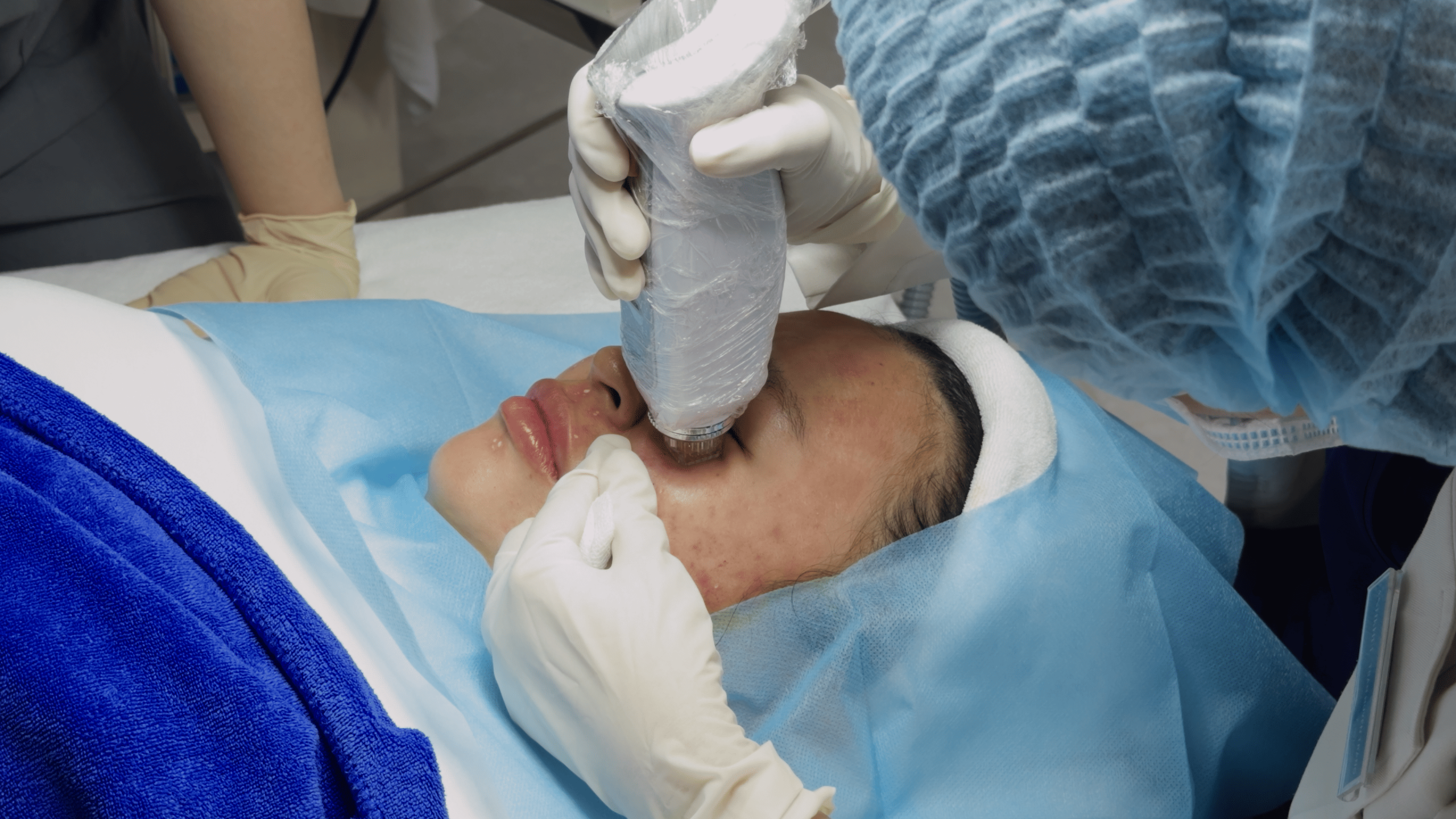 Công nghệ RF Needle Einxel giảm thiểu tổn thương bề mặt , rút ngắn thời gian phục hồi cùng với các công nghệ xâm lấn khác