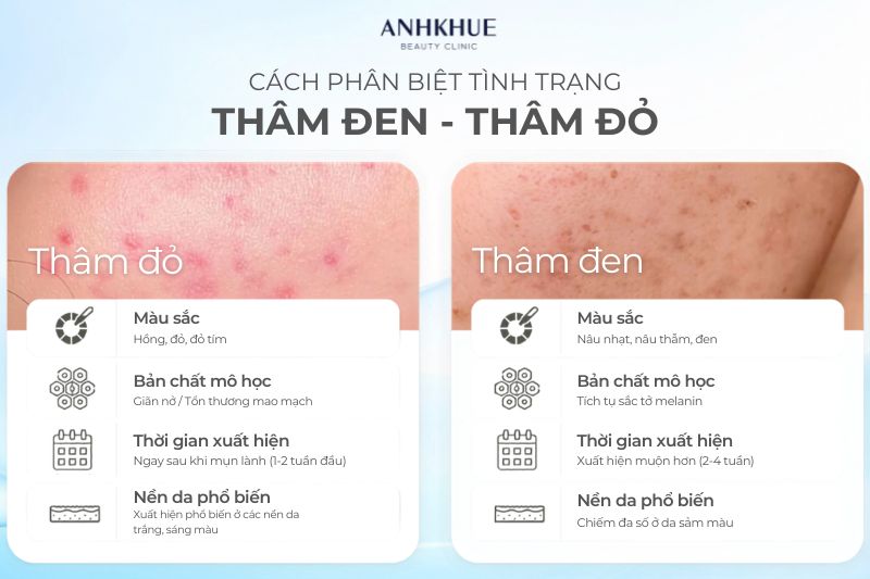 Thâm đỏ chủ yếu  liên quan đến các mạch máu hoặc kích ứng, trong khi đó thâm đen thì liên quan đến các sắc tố melanin